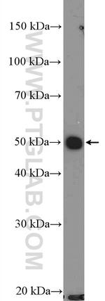 p70(S6K) Antibody in Western Blot (WB)