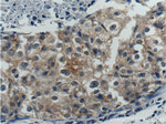 p70(S6K) Antibody in Immunohistochemistry (Paraffin) (IHC (P))