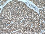 Cardiac Troponin T Antibody in Immunohistochemistry (Paraffin) (IHC (P))