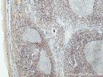 Bcl2 Antibody in Immunohistochemistry (Paraffin) (IHC (P))