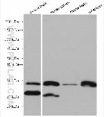 Bcl2 Antibody in Western Blot (WB)