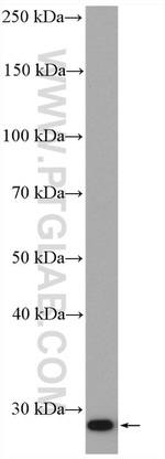 Bcl2 Antibody in Western Blot (WB)