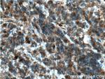 STK17B Antibody in Immunohistochemistry (Paraffin) (IHC (P))