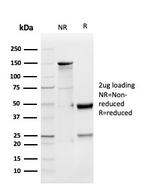 GDF9 (Growth Differentiation Factor 9) Antibody in SDS-PAGE (SDS-PAGE)