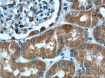 ALDH9A1 Antibody in Immunohistochemistry (Paraffin) (IHC (P))