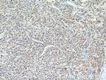 AADAC Antibody in Immunohistochemistry (Paraffin) (IHC (P))