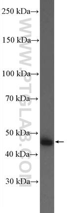 AADAC Antibody in Western Blot (WB)