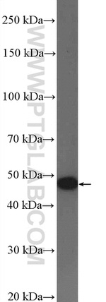 AADAC Antibody in Western Blot (WB)