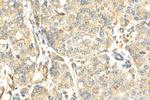 PCID2 Antibody in Immunohistochemistry (Paraffin) (IHC (P))