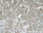 ELAC1 Antibody in Immunohistochemistry (Paraffin) (IHC (P))