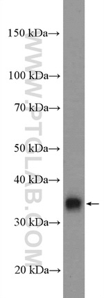 LIN37 Antibody in Western Blot (WB)