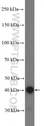 BDKRB1 Antibody in Western Blot (WB)