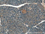 BDKRB1 Antibody in Immunohistochemistry (Paraffin) (IHC (P))