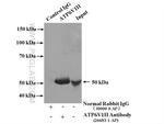 ATP6V1H Antibody in Immunoprecipitation (IP)