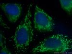 CYR61/CCN1 Antibody in Immunocytochemistry (ICC/IF)