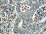 CYR61/CCN1 Antibody in Immunohistochemistry (Paraffin) (IHC (P))