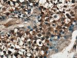 P3H1 Antibody in Immunohistochemistry (Paraffin) (IHC (P))