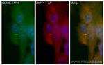 WDR35 Antibody in Immunocytochemistry (ICC/IF)