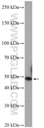 NUCB2/nesfatin-1 Antibody in Western Blot (WB)