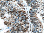 P27/KIP1 Antibody in Immunohistochemistry (Paraffin) (IHC (P))