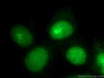 P27/KIP1 Antibody in Immunocytochemistry (ICC/IF)