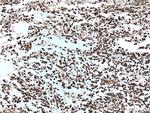 P27/KIP1 Antibody in Immunohistochemistry (Paraffin) (IHC (P))