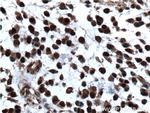 P27/KIP1 Antibody in Immunohistochemistry (Paraffin) (IHC (P))