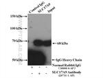 SLC17A9 Antibody in Immunoprecipitation (IP)