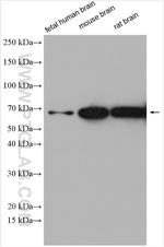 SLC17A9 Antibody in Western Blot (WB)