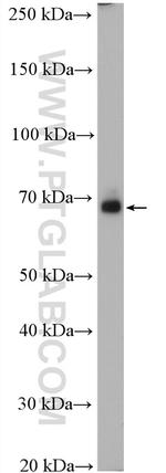 SLC17A9 Antibody in Western Blot (WB)