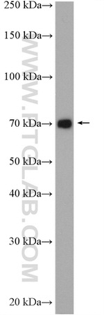 SLC17A9 Antibody in Western Blot (WB)