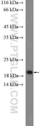 CENPA Antibody in Western Blot (WB)