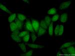 Cyclin D3 Antibody in Immunocytochemistry (ICC/IF)