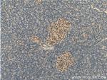 Cyclin D3 Antibody in Immunohistochemistry (Paraffin) (IHC (P))