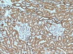 CXCR3 Antibody in Immunohistochemistry (Paraffin) (IHC (P))