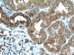 CXCR3 Antibody in Immunohistochemistry (Paraffin) (IHC (P))