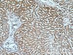 CXCR3 Antibody in Immunohistochemistry (Paraffin) (IHC (P))