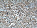 LIF Antibody in Immunohistochemistry (Paraffin) (IHC (P))