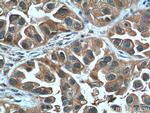 LIF Antibody in Immunohistochemistry (Paraffin) (IHC (P))