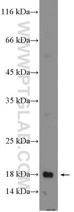 LIF Antibody in Western Blot (WB)