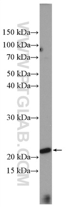 LIF Antibody in Western Blot (WB)