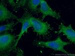 SUFU Antibody in Immunocytochemistry (ICC/IF)