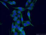 SUFU Antibody in Immunocytochemistry (ICC/IF)