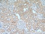 SUFU Antibody in Immunohistochemistry (Paraffin) (IHC (P))