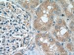 SUFU Antibody in Immunohistochemistry (Paraffin) (IHC (P))