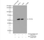 SUFU Antibody in Immunoprecipitation (IP)