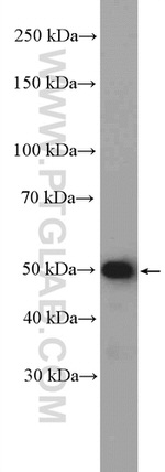 SUFU Antibody in Western Blot (WB)