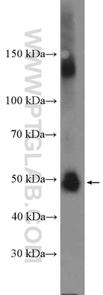 SUFU Antibody in Western Blot (WB)