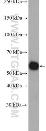 SUFU Antibody in Western Blot (WB)