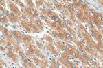 Plasminogen Antibody in Immunohistochemistry (Paraffin) (IHC (P))